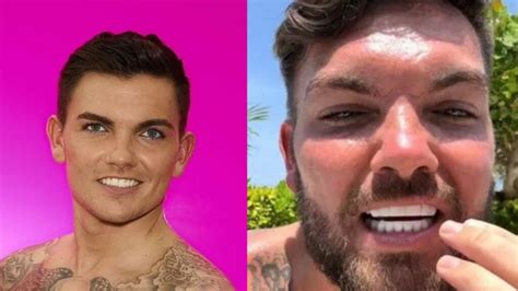 sam gowland turkey teeth.